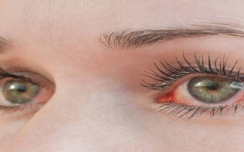Explosão de queimadas compromete a saúde ocular
