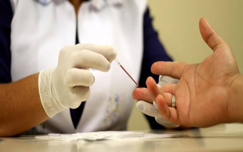 Brasil registra menor mortalidade por aids da série histórica