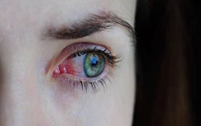 Gripe e resfriado aumentam casos de conjuntivite