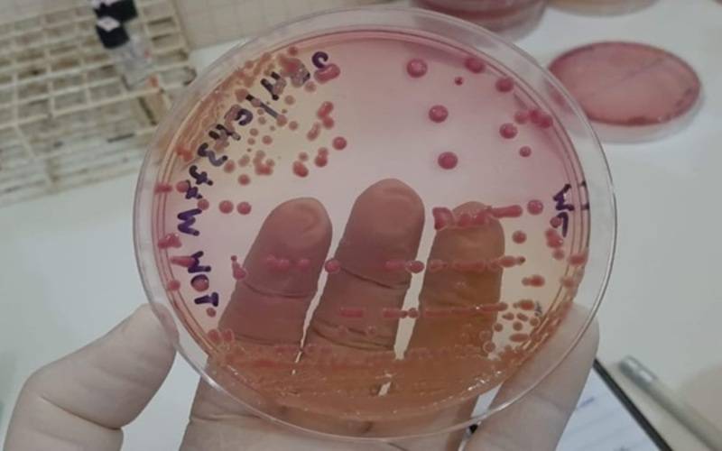 Estudo avalia prevalência de bactérias multirresistentes em hospitais