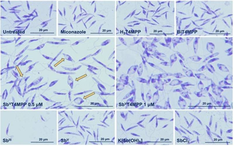 Nova molécula mostra potencial contra leishmanioses e pode superar resistência a trata