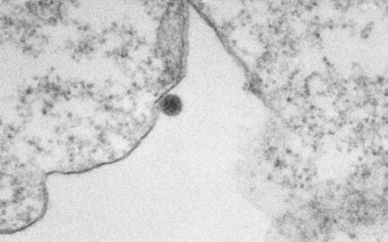 Imagens de microscopia mostram vírus Oropouche em ação
