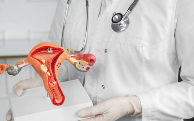 União amplia atendimento do SUS a mulheres com endometriose profunda