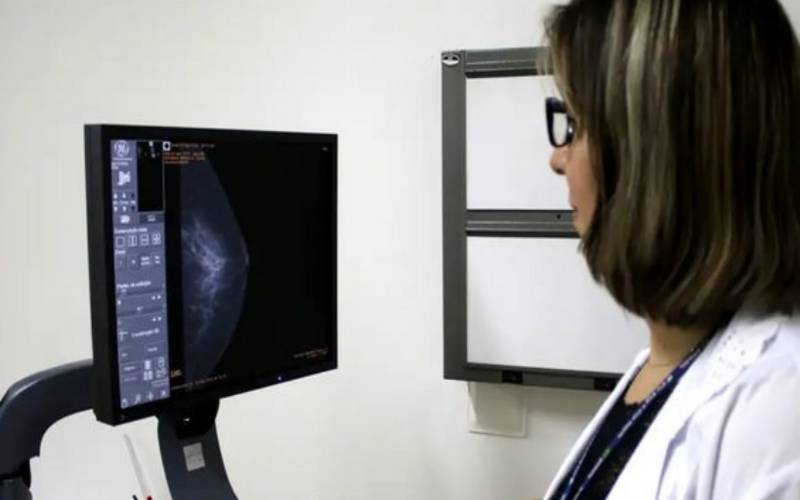 Ministério da Saúde padroniza informações para acesso ao exame de mamografia no SUS