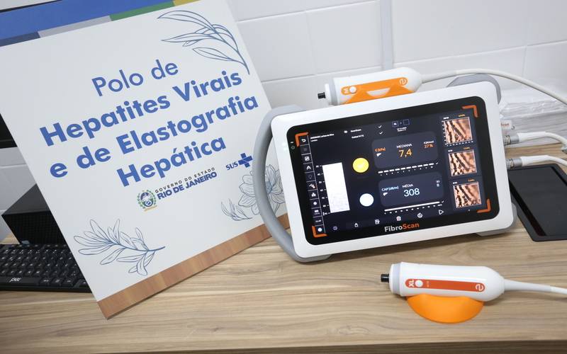 Rede estadual de Saúde adquire aparelho de alta tecnologia para diagnosticar doenças n