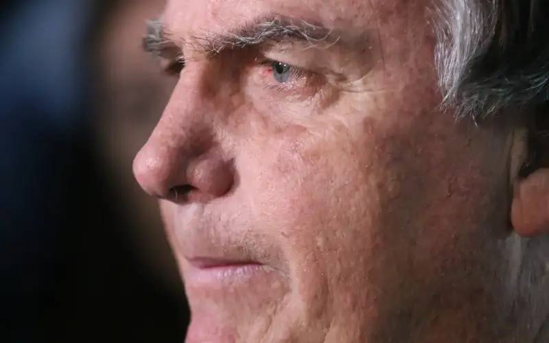 Com crise persistente de soluços, Bolsonaro faz nova cirurgia