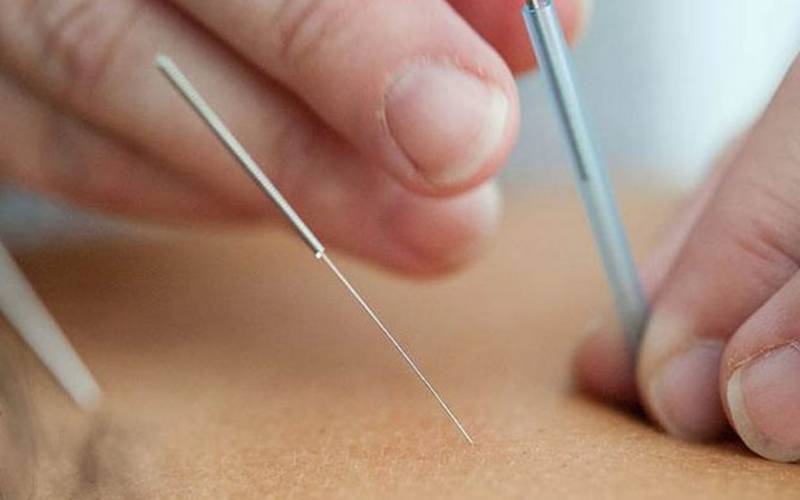 Governo do Brasil regulamenta o exercício profissional de acupuntura