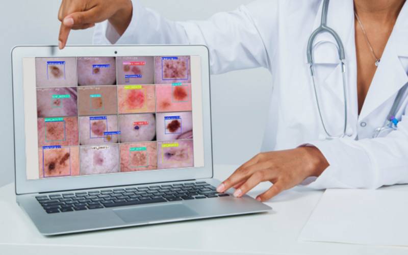 Modelo de IA apoia diagnóstico de câncer de pele