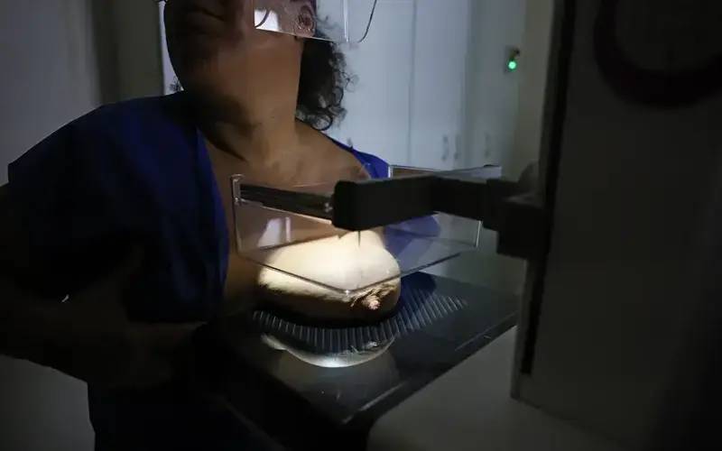 ANS defende que plano cubra mamografia digital sem restrição de idade