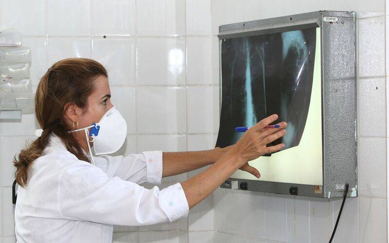 Casos de tuberculose reduzem 41,8% na cidade